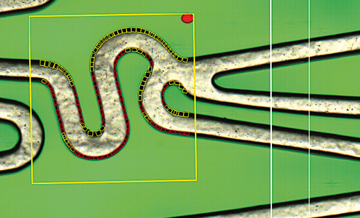 photoSurface_StentEdges Strut Edges measurement for stents