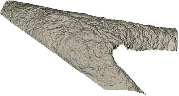 3d-surface-stent_lr