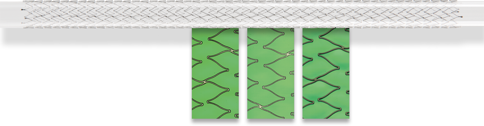 SensoINSPECT software stent_fullwidth SensoINSPECT software