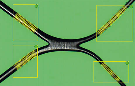 stent_regions_lr Strut width stent Q six