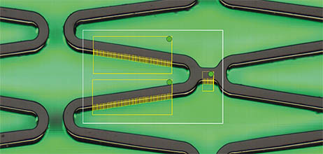 wallthickness_1_lr wall thikness measurement of stents Q six