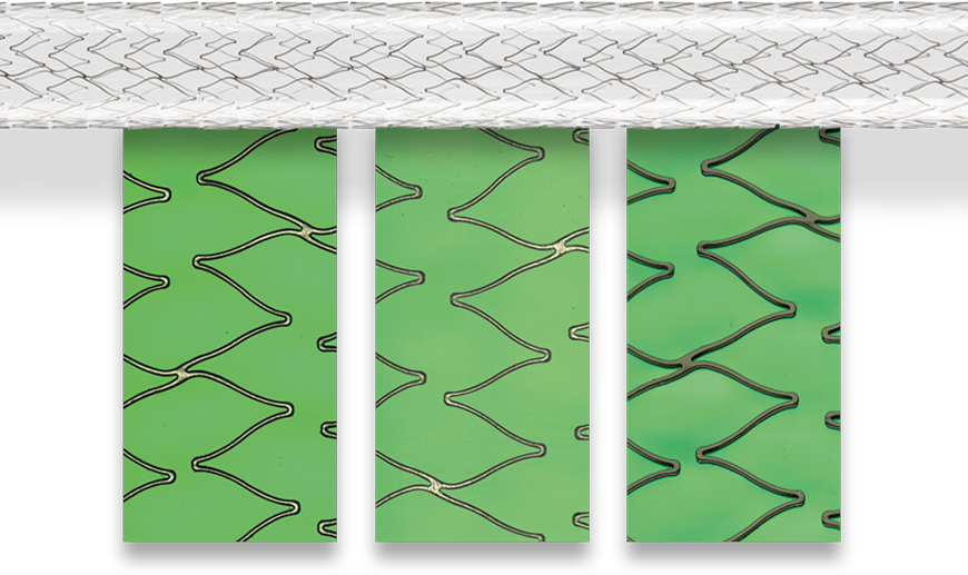 SensoINSPECT software stent unrolled SensoINSPECT software stent unrolled
