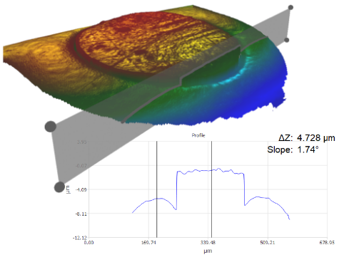 grupo-262 Stent Markers in 3D